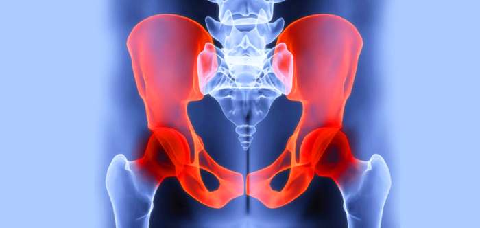 Source of Pelvic Pain