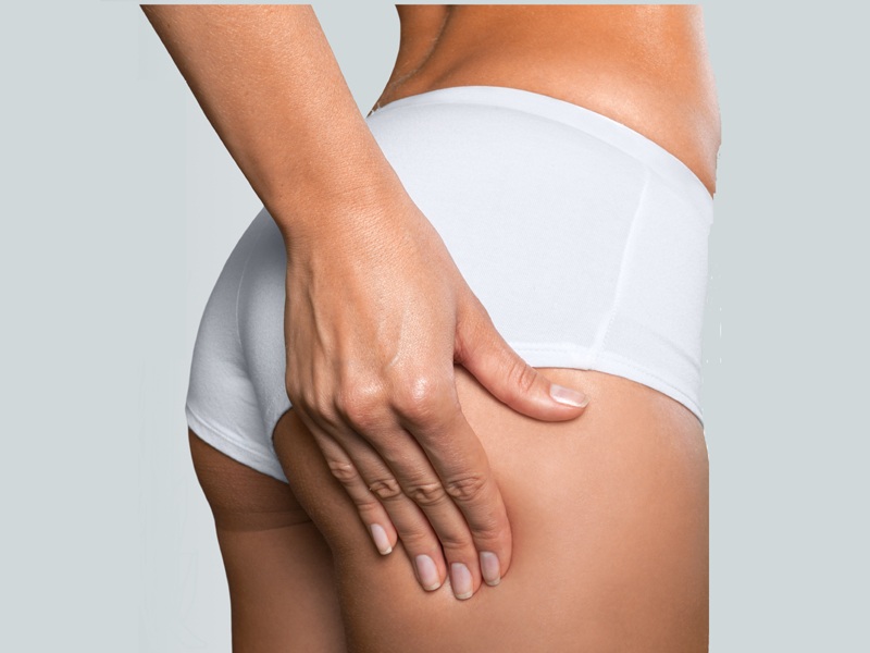 How To Lose Hip Fat Without Exercise