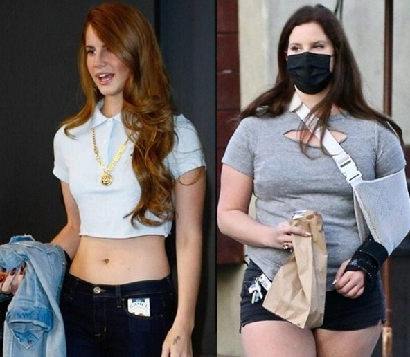 Lana Del Rey's weight gain